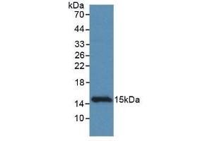 Detection of Recombinant CCDC60, Rat using Monoclonal Antibody to Coiled Coil Domain Containing Protein 60 (CCDC60) (CCDC60 anticorps  (AA 127-236))