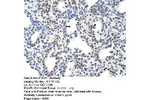 Rabbit Anti-FUSIP1 Antibody  Paraffin Embedded Tissue: Human Lung Cellular Data: Alveolar cells Antibody Concentration: 4. (SRSF10 anticorps  (C-Term))