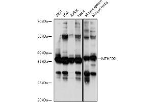 Western blot analysis of extracts of various cell lines, using MTHFD2 antibody (ABIN6132367, ABIN6144144, ABIN6144145 and ABIN6214625) at 1:1000 dilution. (MTHFD2 anticorps  (AA 40-250))