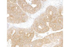 anti-La Ribonucleoprotein Domain Family, Member 1 (LARP1) (AA 275-325) antibody