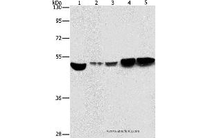 Western blot analysis of Hela and A431 cell, mouse brain and liver tissue, mouse pancreas tissue, using ENO1 Polyclonal Antibody at dilution of 1:500 (ENO1 anticorps)