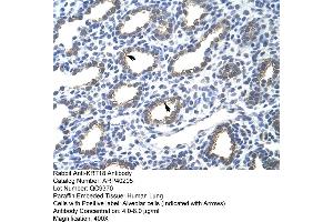 Rabbit Anti-KRT18 Antibody  Paraffin Embedded Tissue: Human Lung Cellular Data: Alveolar cells Antibody Concentration: 4.