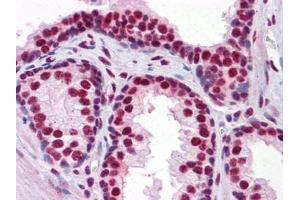 Immunohistochemistry (IHC) image for anti-Runt-Related Transcription Factor 2 (RUNX2) (AA 251-351) antibody (ABIN614586)