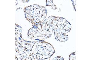 Immunohistochemistry of paraffin-embedded human placenta using PDK4 Rabbit pAb (ABIN6132477, ABIN6145396, ABIN6145397 and ABIN6217290) at dilution of 1:100 (40x lens).