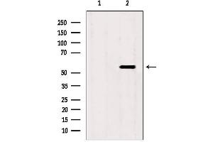 Western blot analysis of extracts from mouse spleen, using SKAP2 antibody.