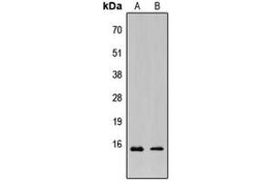 Western blot analysis of KCNE1L expression in HeLa (A), MCF7 (B) whole cell lysates. (KCNE1-Like anticorps  (Center))