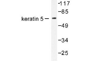 Image no. 1 for anti-Keratin 5 (KRT5) antibody (ABIN265501)