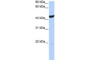 WB Suggested Anti-KRT23 Antibody Titration:  0. (KRT23 anticorps  (Middle Region))