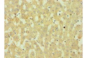 Immunohistochemistry of paraffin-embedded human liver tissue using ABIN7149891 at dilution of 1:100 (DKK4 anticorps  (AA 19-224))