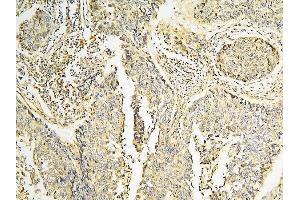 IHC analysis of CPAMD8 using anti-CPAMD8 antibody (ABIN6719649). (CPAMD8 anticorps  (AA 58-234))