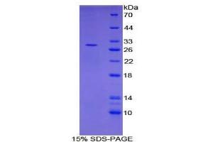 SDS-PAGE analysis of Human PIAS1 Protein. (PIAS1 Protéine)