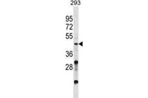 VSX2 Antibody (C-term) western blot analysis in 293 cell line lysates (35 µg/lane). (VSX2 anticorps  (C-Term))