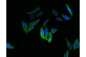Immunofluorescent analysis of HepG2 cells using ABIN7171996 at dilution of 1:100 and Alexa Fluor 488-congugated AffiniPure Goat Anti-Rabbit IgG(H+L)