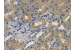 DAB staining on IHC-P; Samples: Rat Kidney Tissue
