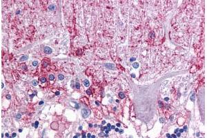 Human Brain, Cerebellum: Formalin-Fixed, Paraffin-Embedded (FFPE)