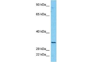 Host:  Rabbit  Target Name:  CBR3  Sample Type:  COLO205 Whole Cell lysates  Antibody Dilution:  1. (CBR3 anticorps  (Middle Region))