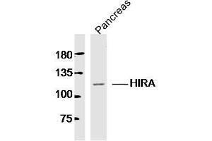 Mouse pancreas lysates probed with HIRA Polyclonal Antibody, Unconjugated  at 1:300 dilution and 4˚C overnight incubation.