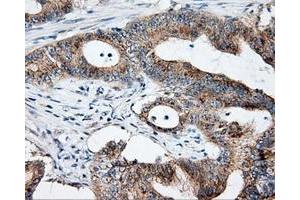 Immunohistochemical staining of paraffin-embedded Kidney tissue using anti-NME4 mouse monoclonal antibody. (NME4 anticorps)