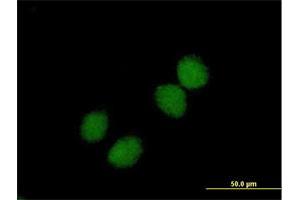 Immunofluorescence of purified MaxPab antibody to CHKB on HeLa cell.