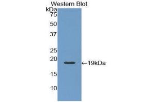 Western Blotting (WB) image for anti-Angiopoietin 1 (ANGPT1) (AA 284-452) antibody (ABIN1857989) (Angiopoietin 1 anticorps  (AA 284-452))