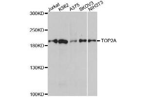 Western blot analysis of extracts of various cell lines, using TOP2A antibody. (Topoisomerase II alpha anticorps)
