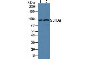 Figure. (Fibulin 1 anticorps  (AA 176-398))