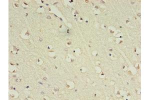Immunohistochemistry of paraffin-embedded human brain tissue using ABIN7153483 at dilution of 1:100