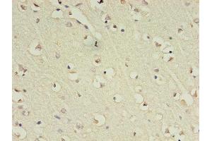 Immunohistochemistry of paraffin-embedded human brain tissue using ABIN7153483 at dilution of 1:100 (GABRA4 anticorps  (AA 36-258))