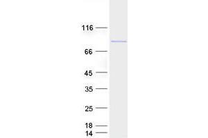 Validation with Western Blot