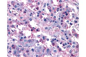 Anti-VIPR1 / RDC1 antibody IHC of human adrenal.