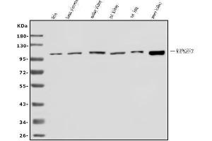 Western blot analysis of Epac1/RAPGEF3 using anti-Epac1/RAPGEF3 antibody (ABIN7601784).