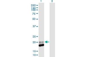 Lane 1: IFNA13 transfected lysate ( 21.