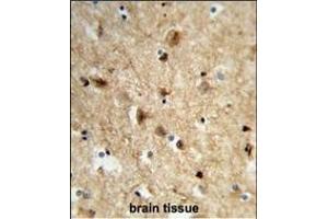 anti-Neuralized Homolog (Drosophila) (NEURL) (AA 158-186) antibody