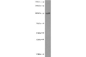 Western Blotting (WB) image for anti-Luteinizing Hormone/Choriogonadotropin Receptor (LHCGR) antibody (ABIN2937954) (LHCGR anticorps)