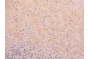 DAB staining on IHC-P; Samples: Human Liver Tissue