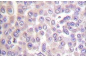 Image no. 1 for anti-Phospholipase A2, Group IVB (Cytosolic) (PLA2G4B) antibody (ABIN271921)