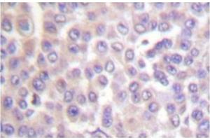 Image no. 1 for anti-Phospholipase A2, Group IVB (Cytosolic) (PLA2G4B) antibody (ABIN271921) (PLA2G4B anticorps)
