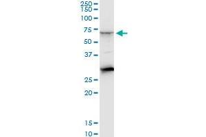 CTNS monoclonal antibody (M09), clone 5G6. (CTNS anticorps  (AA 1-100))