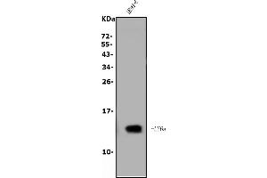 Western blot analysis of Sca1/Ly6A/E using anti-Sca1/Ly6A/E antibody (ABIN5518854).