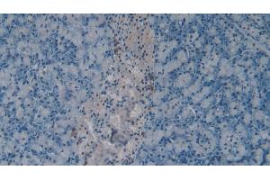 Detection of CHEM in Mouse Pancreas Tissue using Polyclonal Antibody to Chemerin (CHEM) (CHEM (AA 21-155) anticorps)