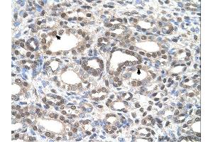 Immunohistochemistry (IHC) image for anti-Deafness, Autosomal Dominant 5 (DFNA5) (C-Term) antibody (ABIN2782489)