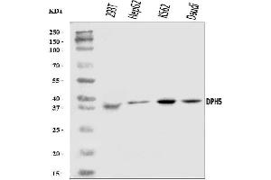 Western blot analysis of DPH5 using anti-DPH5 antibody (ABIN7599711).