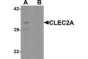 Western blot analysis of CLEC2A in K562 cell lysate with CLEC2A antibody at 1 µg/mL in (A) the absence and (B) the presence of blocking peptide. (CLEC2A anticorps  (N-Term))