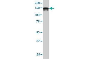 STAG2 monoclonal antibody (M01), clone 3C6 Western Blot analysis of STAG2 expression in Hela S3 NE .