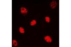 Immunofluorescent analysis of HNF4 alpha/gamma staining in HeLa cells. (HNF4 alpha/gamma anticorps)