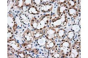 Immunohistochemical staining of paraffin-embedded Kidney tissue using anti-PSMC3 mouse monoclonal antibody. (PSMC3 anticorps)
