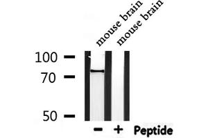 Western blot analysis of extracts from mouse  brain, using FZD3 Antibody.
