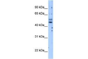 PIK3R3 antibody used at 5 ug/ml to detect target protein. (PIK3R3 anticorps)