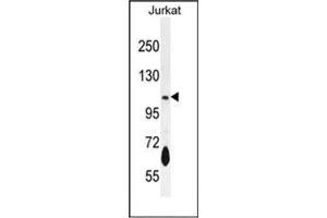 Western blot analysis of PDE3B Antibody (Center) in Jurkat cell line lysates (35ug/lane). (PDE3B anticorps  (Middle Region))