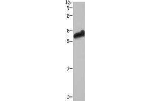 Western Blotting (WB) image for anti-Glutathione S-Transferase alpha 3 (GSTA3) antibody (ABIN2430213) (GSTA3 anticorps)